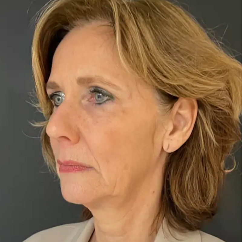 Younger skin