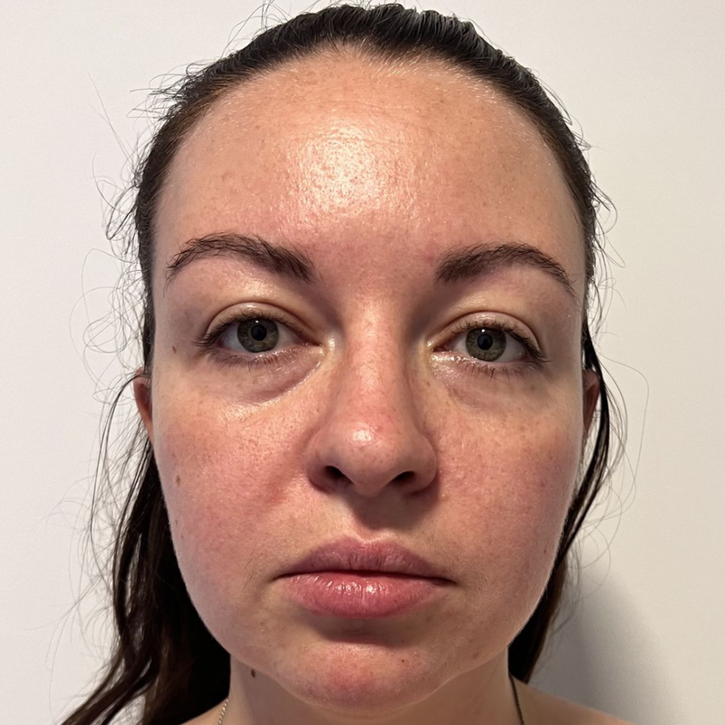 Younger skin