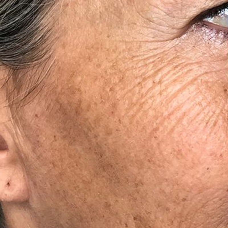 Less wrinkles