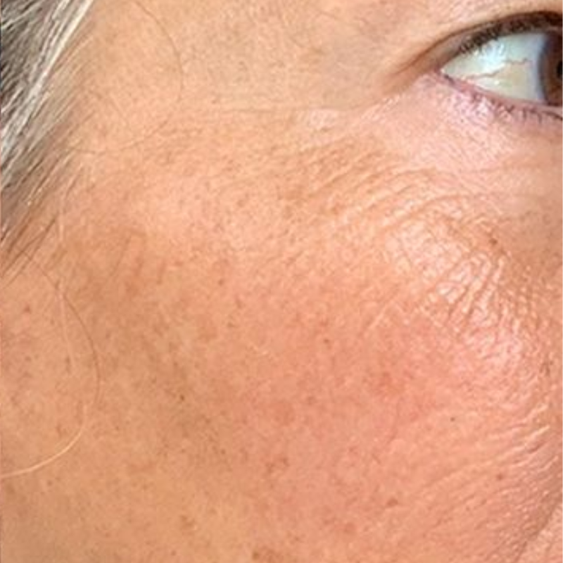 Less wrinkles